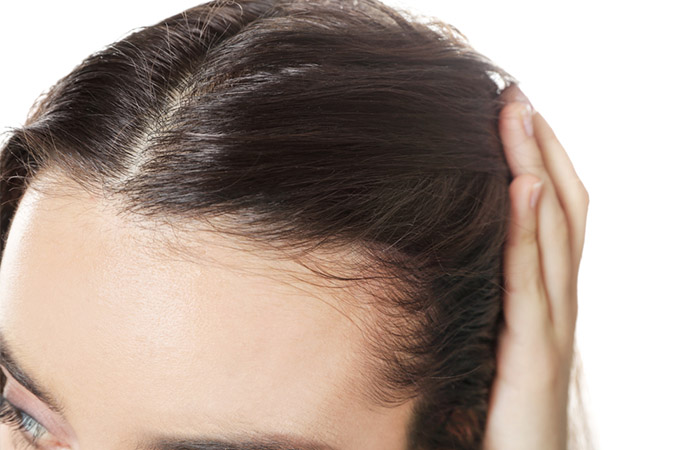 Closeup of the hairline of a woman