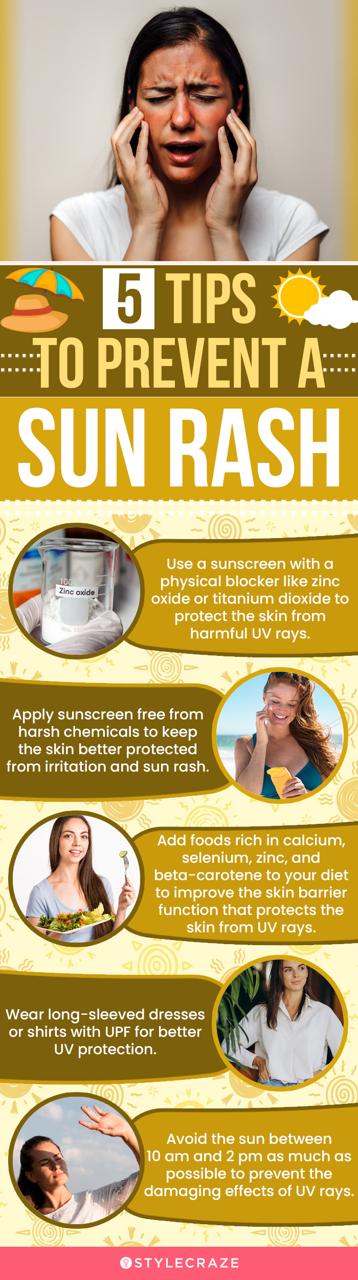  5 tips to prevent sun rash (infographic)