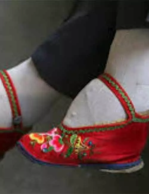 Foot-Binding