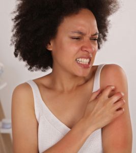 How To Treat Eczema On Black Skin?