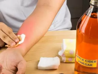 How To Use Apple Cider Vinegar For Skin Tag Removal