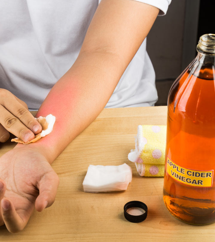 How To Use Apple Cider Vinegar For Skin Tag Removal