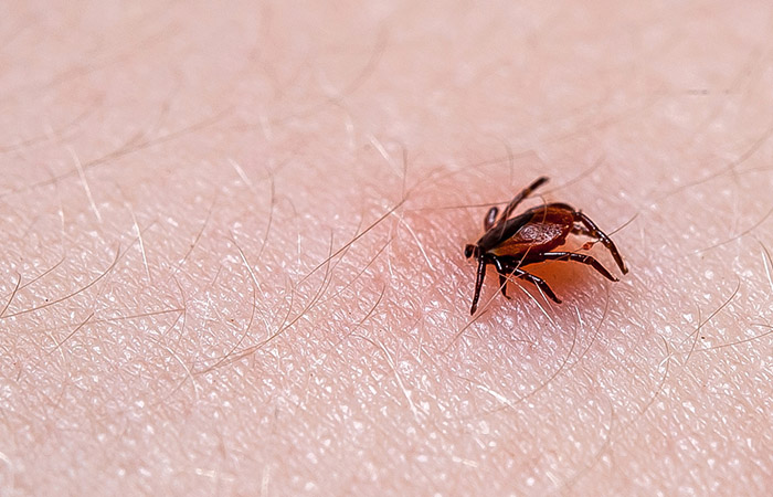 Monolaurin may help fight lyme disease
