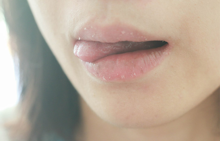 Dry lips and dry mouth are symptoms that accompany adderall tongue