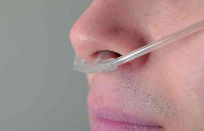 Person using nasal catheter to treat cyanosis