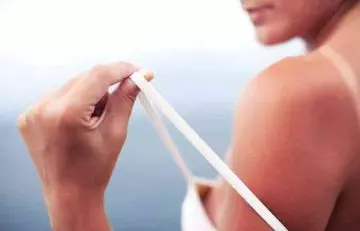 Woman with sun rashes on her back and arms