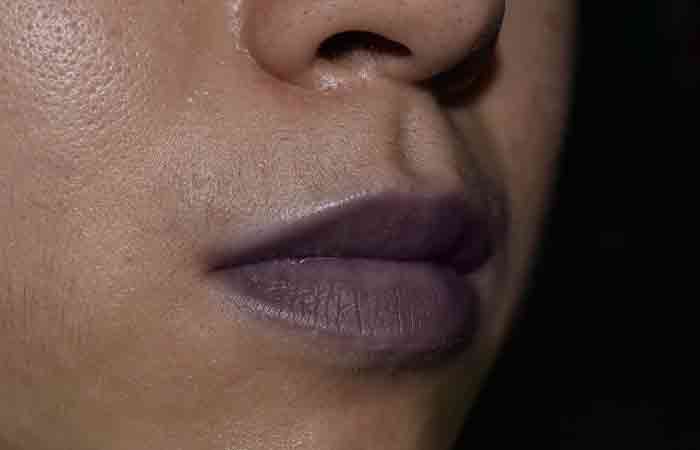 Closeup of cyanosis on a person's lips