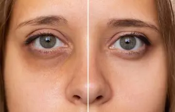 Cropped shot of a young female face showing dark circles under the eyes before and after using green apples.
