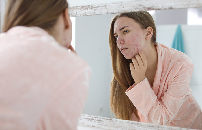 Woman with skin issues may benefit from gelatin