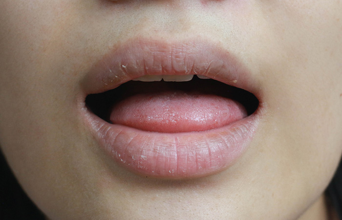 Close up of a woman with dry mouth symptoms as a side effect of asparagus