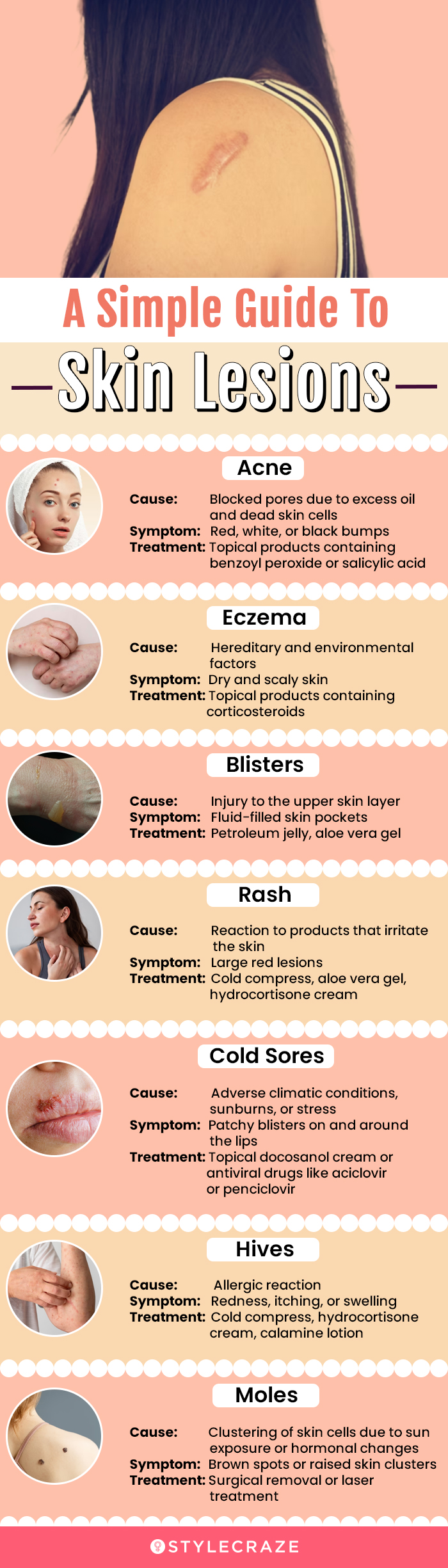 a simple guide to skin lesions (infographic)