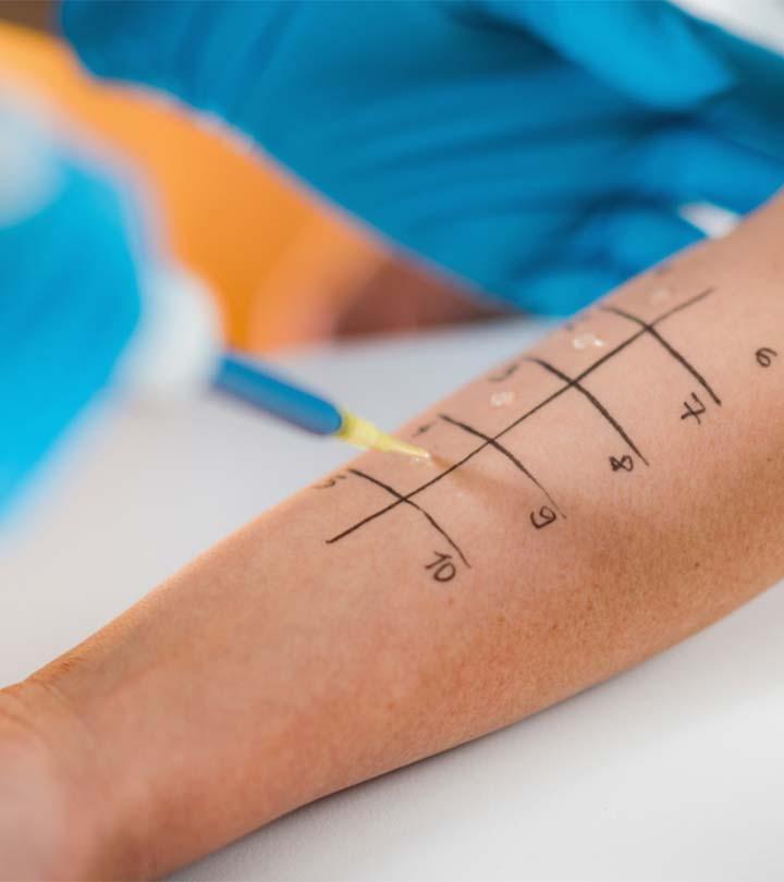 Allergy Skin Tests: Types, Procedures, And Risks