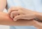 Skin Induration: Symptoms, Causes, An...