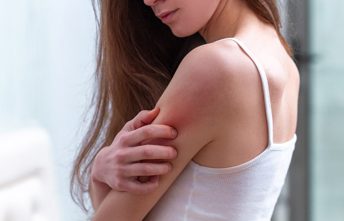 Itching is a symptom of dry skin