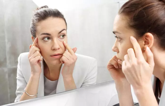 Woman with aging skin due to drop in collagen levels