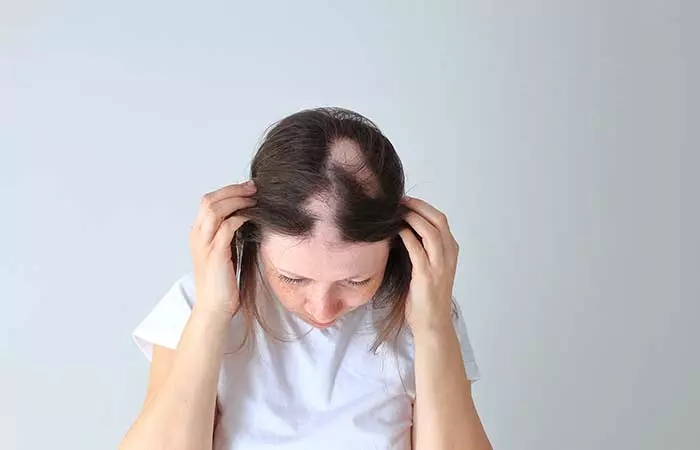 Trichotillomania