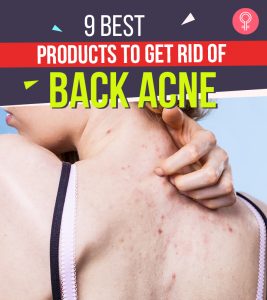 9 Best Products To Get Rid Of Back Acne