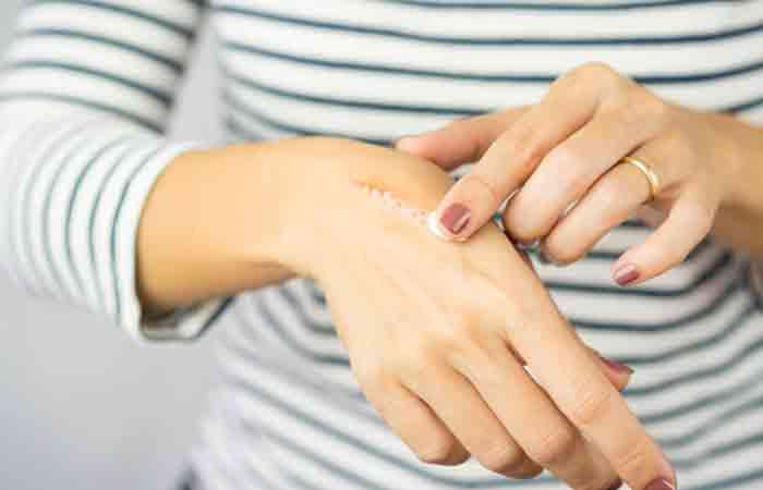 Kokum butter may heal wounds