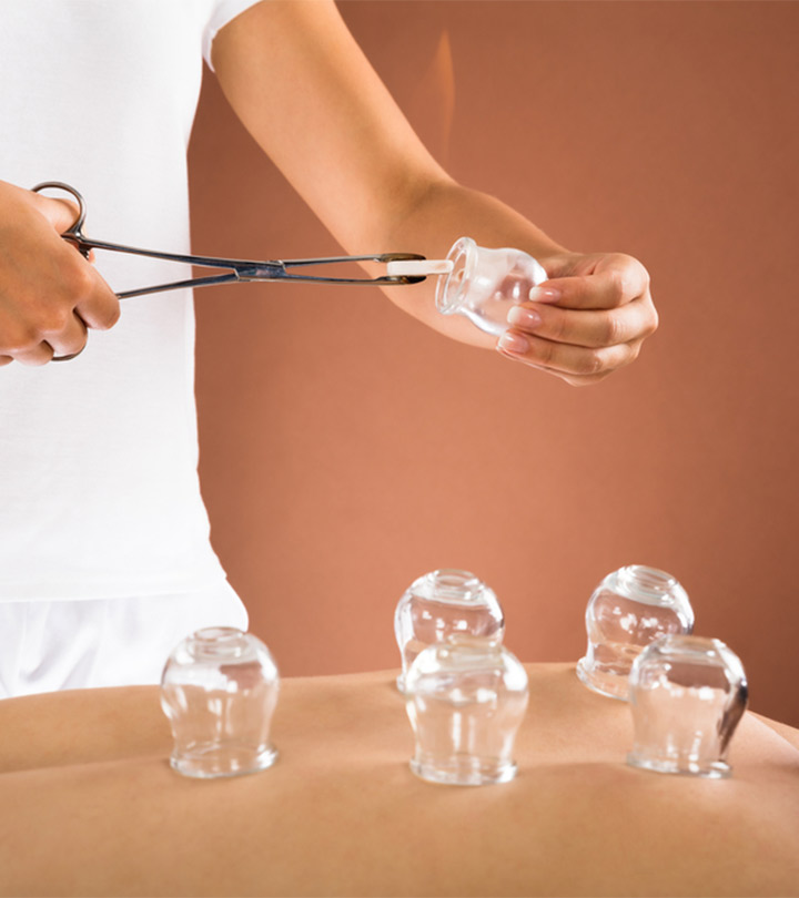 Cupping Therapy: Benefits, Side Effects, And More