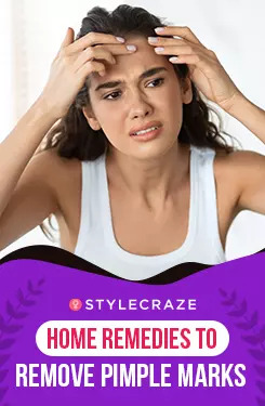 Home Remedies to Remove Pimple Marks