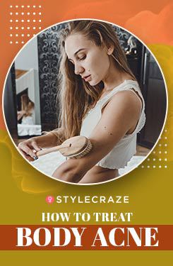 How to Treat Body Acne