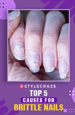 Top 5 Causes For Brittle Nails