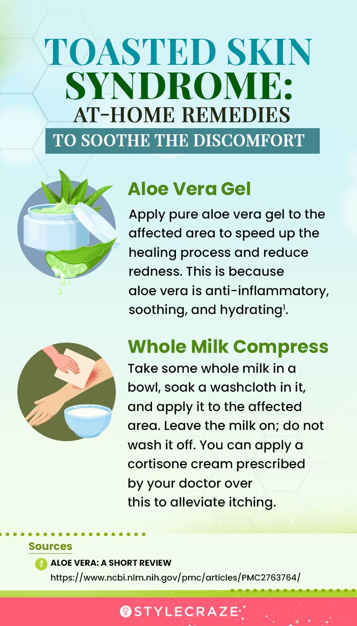 home remedies for toasted skin (infographic)
