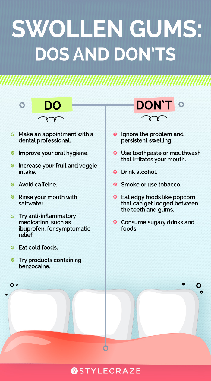 facts about swollen gums (infographic)