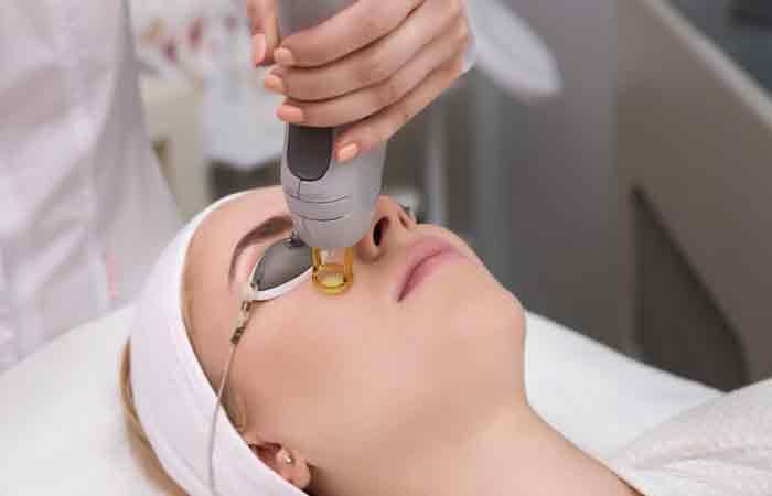 Face-Waxing-And-Face-Laser-Treatments