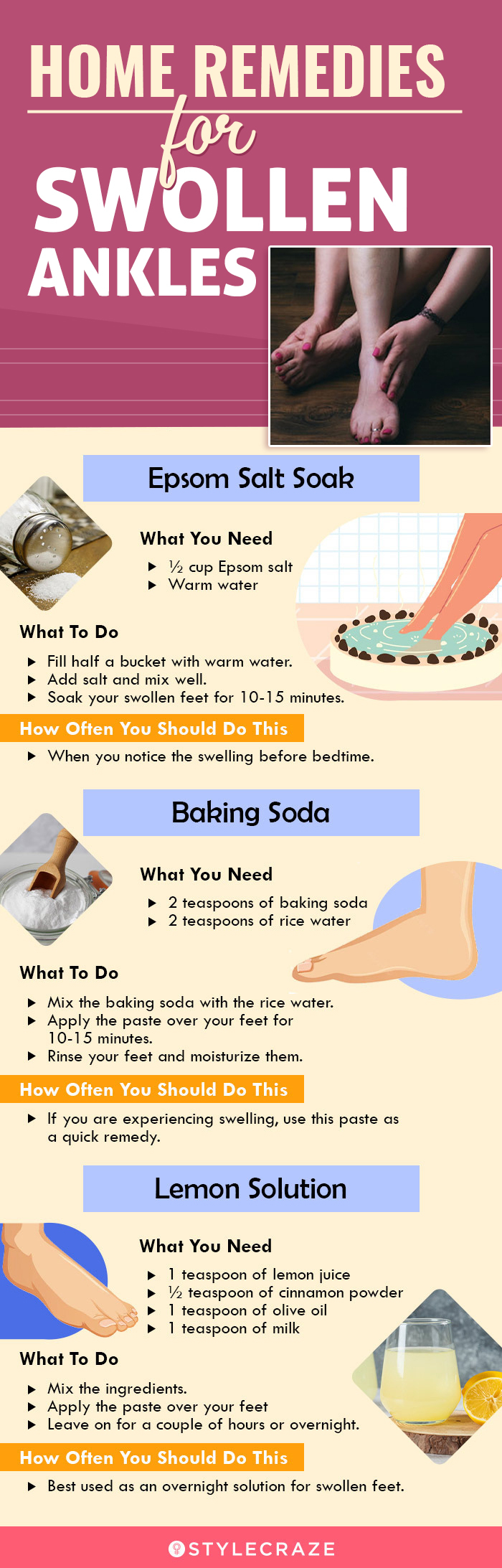 remedies for swollen ankles (infographic)