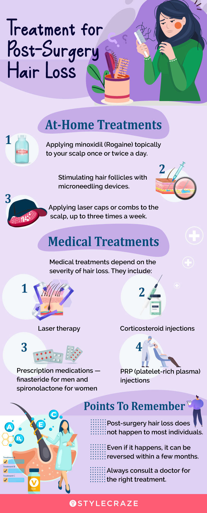 treatment fro post-surgery hair loss (infographic)