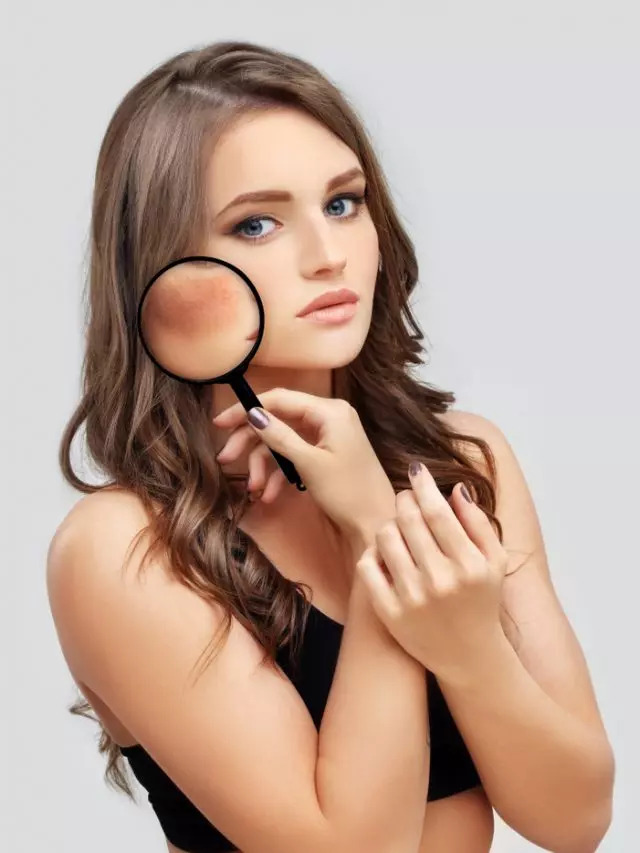 Struggling With Hyperpigmentation? Try These Ingredients