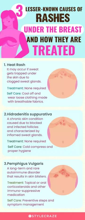 lesser known causes of rashes under the breast and how they are treated (infographic)