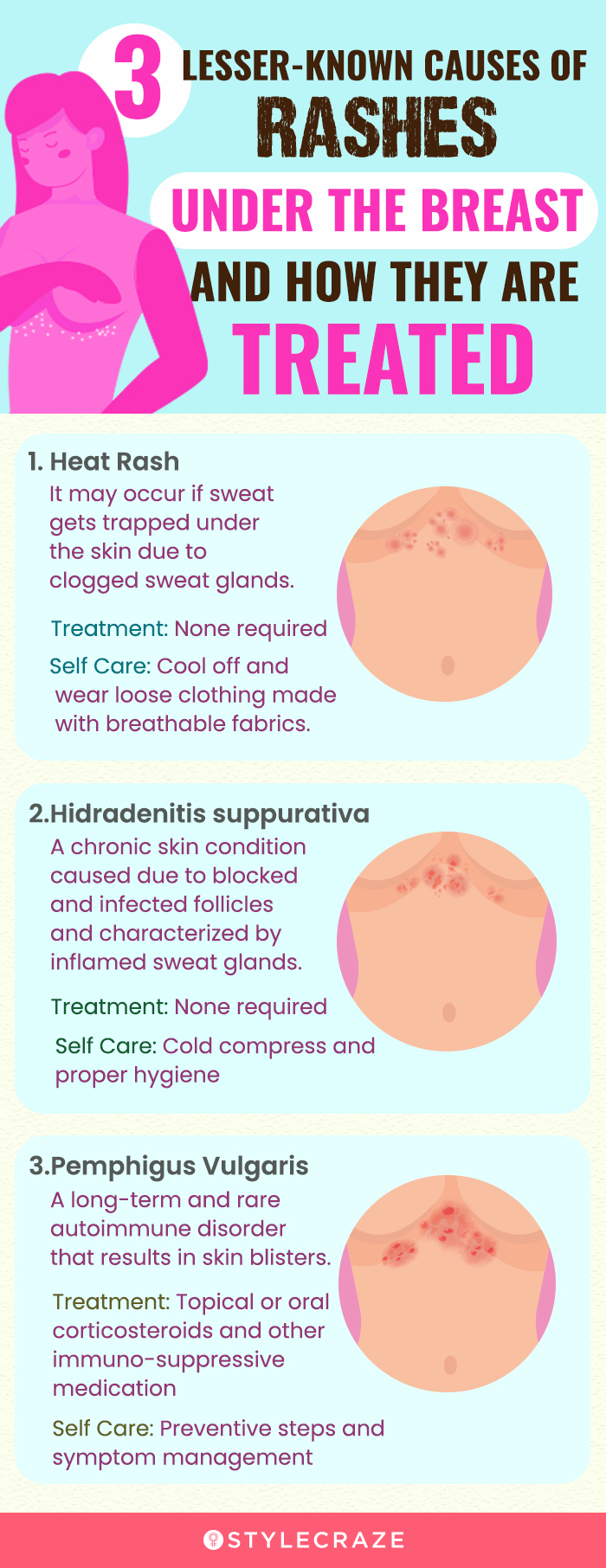 lesser known causes of rashes under the breast and how they are treated (infographic)