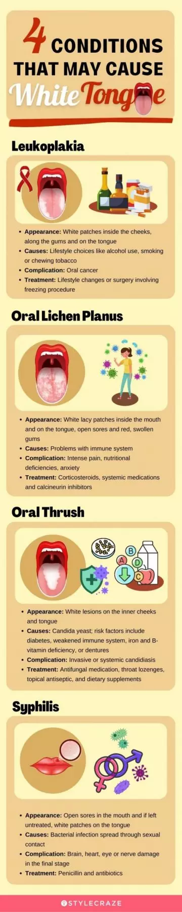 4 conditions that may cause white tongue (infographic)