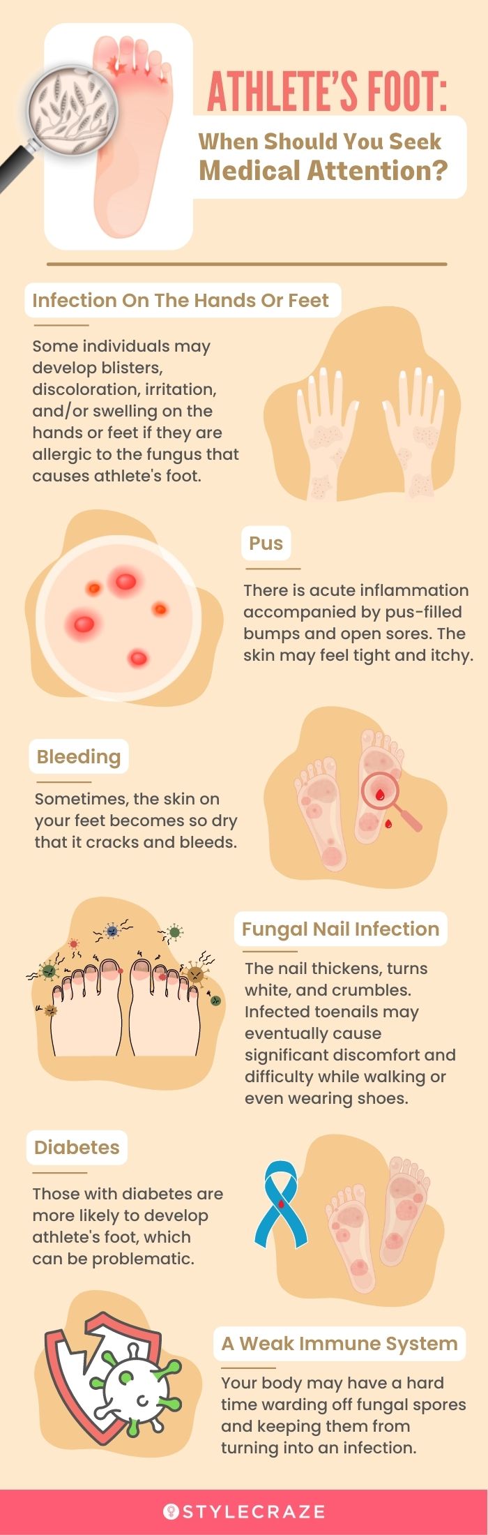 athlete’s foot when should you seek medical attention (infographic)