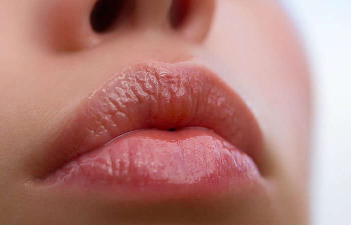 Bow-shaped lips