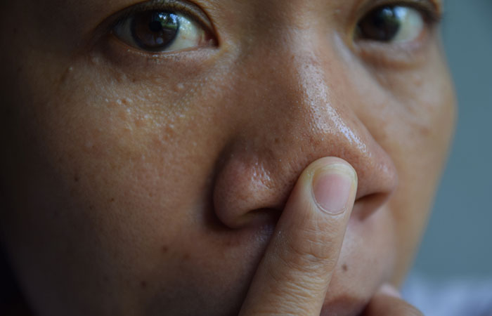 Close up of woman showing her oily nose