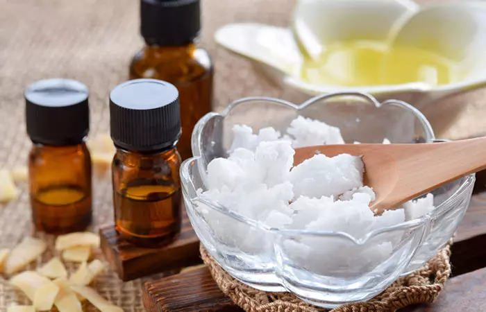 Coconut oil and essential oils for psoriasis
