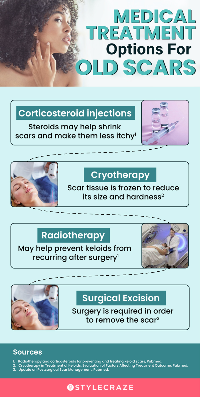medical treatment options for old scars (infographic)