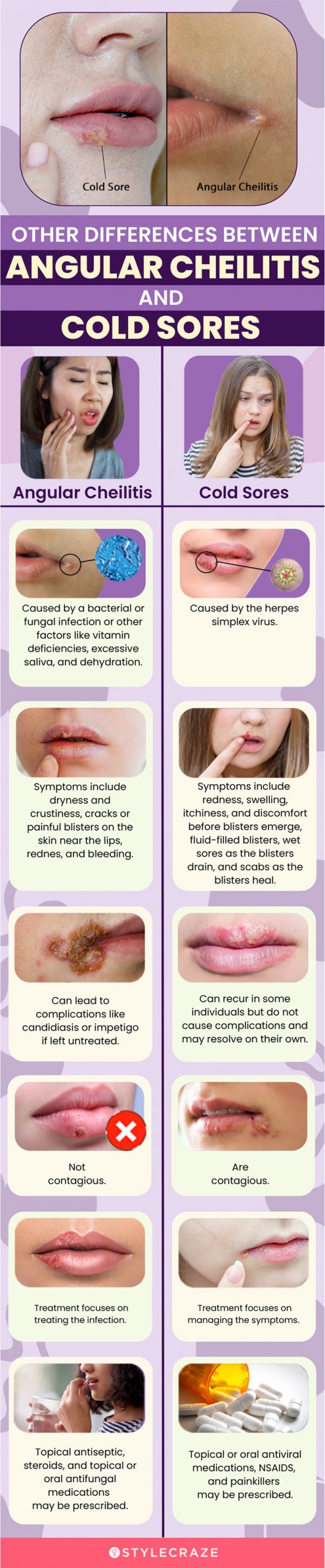 other differences between angular cheilitis and cold sores (infographic)