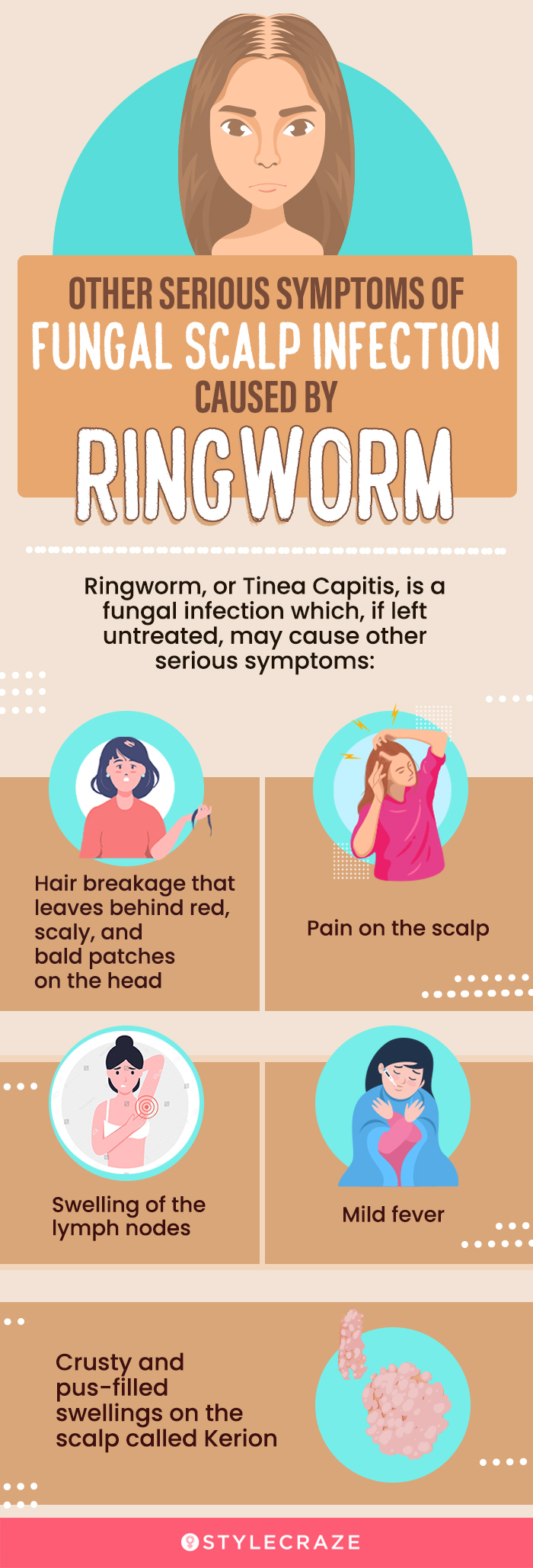 other serious symptoms of fungal scalp infection caused by ringworm (infographic)