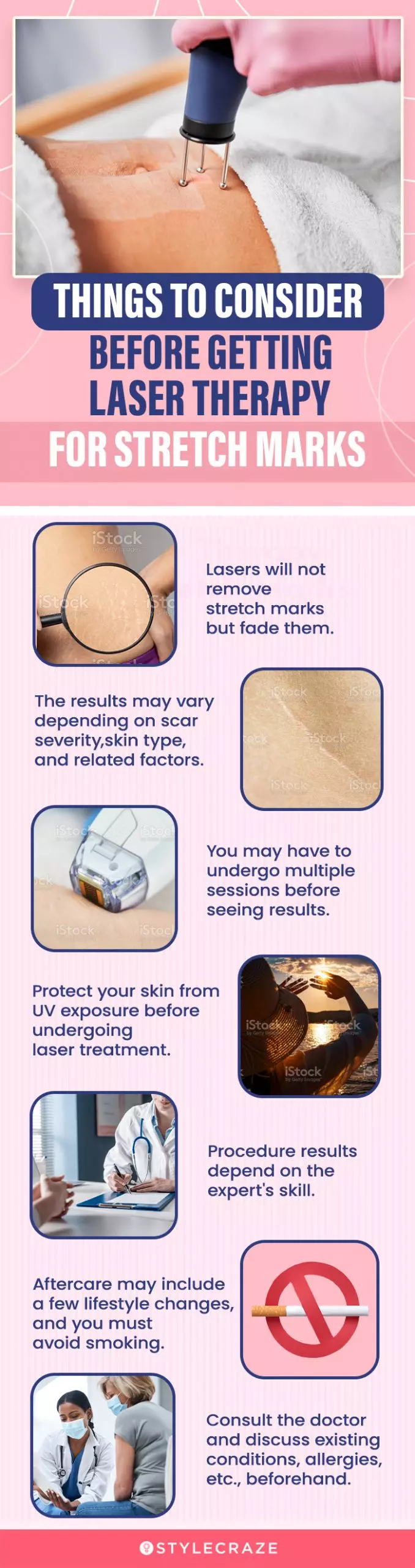 things to consider before getting laser therapy for stretch marks (infographic)