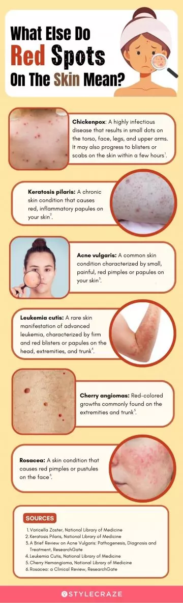 what else do red spots on the skin mean (infographic)