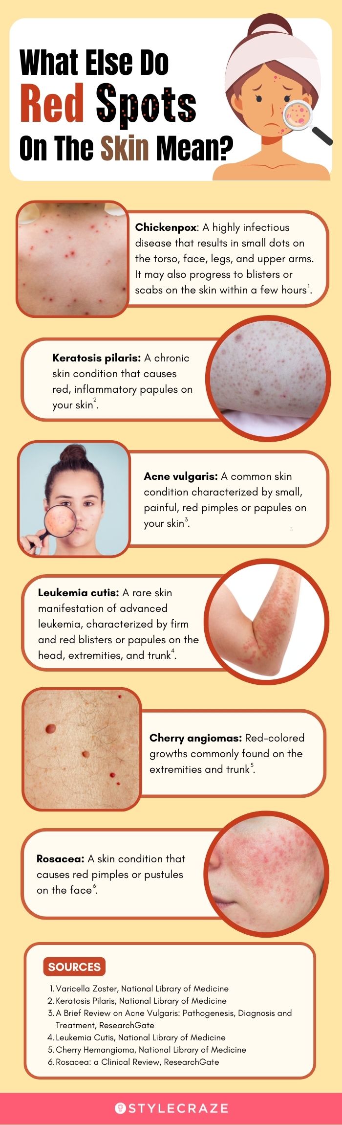 what else do red spots on the skin mean (infographic)