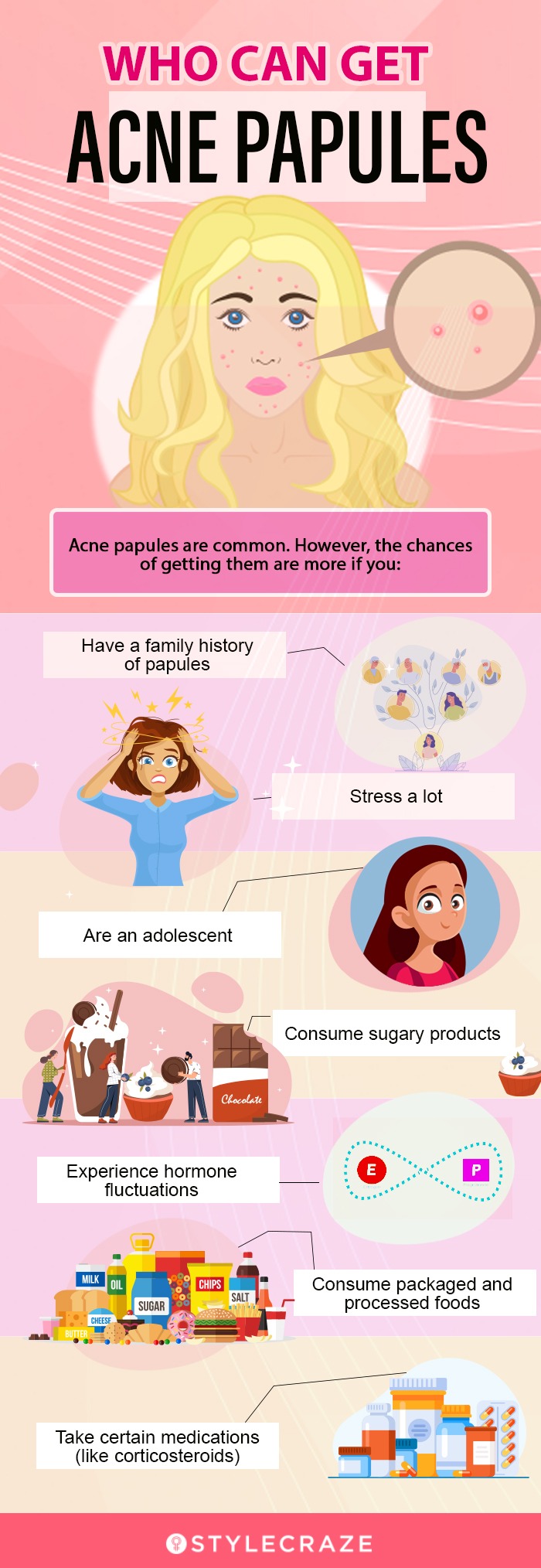 who can get acne papules (infographic)