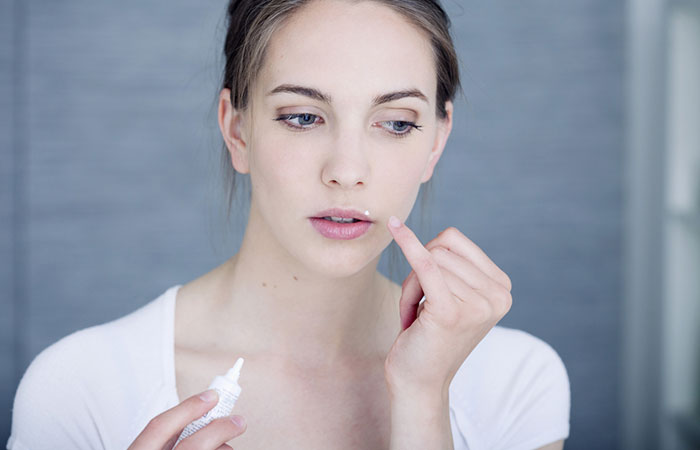 Woman applying medicine to the lip pimple