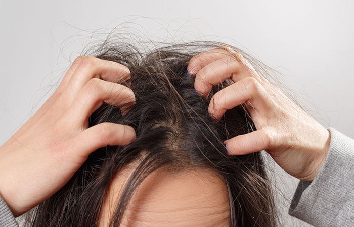 Woman experiencing dry and itchy scalp as a side effect of grape seed extract 