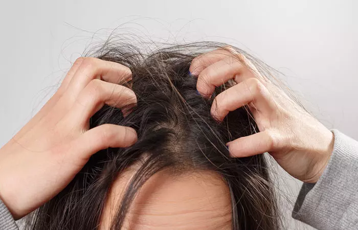 Woman experiencing dry and itchy scalp as a side effect of grape seed extract 