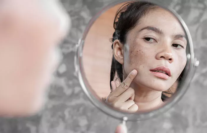 Woman looking at her dark spots in the mirror